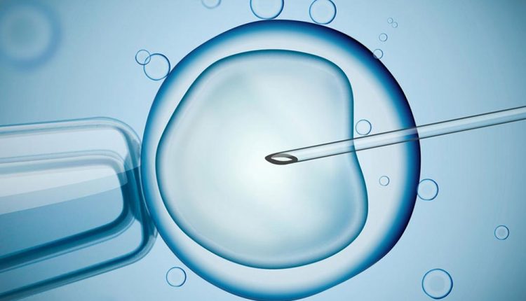 آی وی اف - IVF