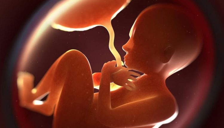 جداشدن زودرس جفت