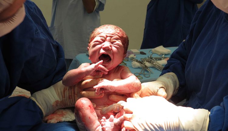 اپیزیوتومی