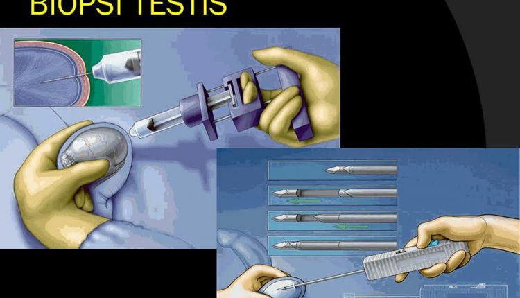 تشخیص ناباروری مردان