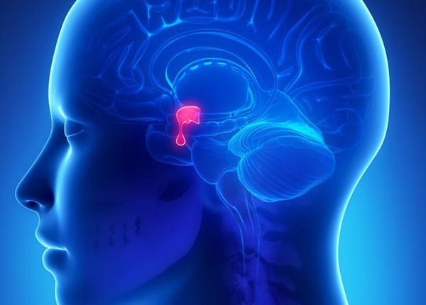 هایپر پرولاکتینمی