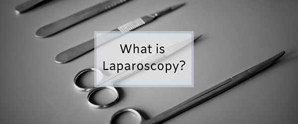 لاپاراسکوپی چیست