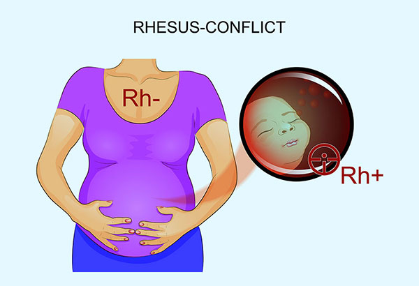 آزمایش Rh خون در بارداری