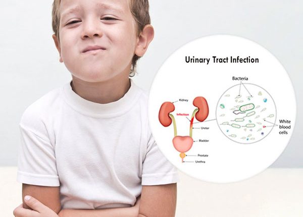 عفونت ادراری در کودکان
