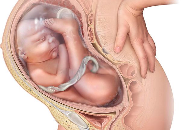 تشخیص وضعیت بریچ جنین