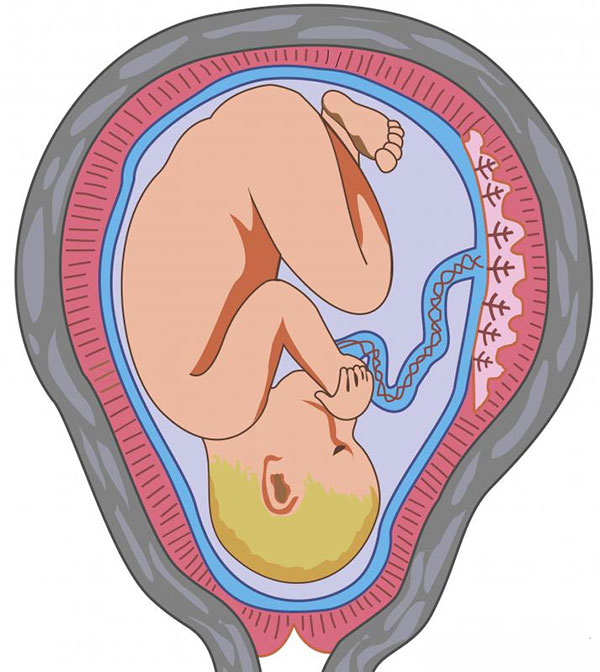 وضعیت سفالیک جنین